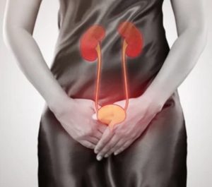 Infeksi Saluran Kemih Sering pada Wanita
